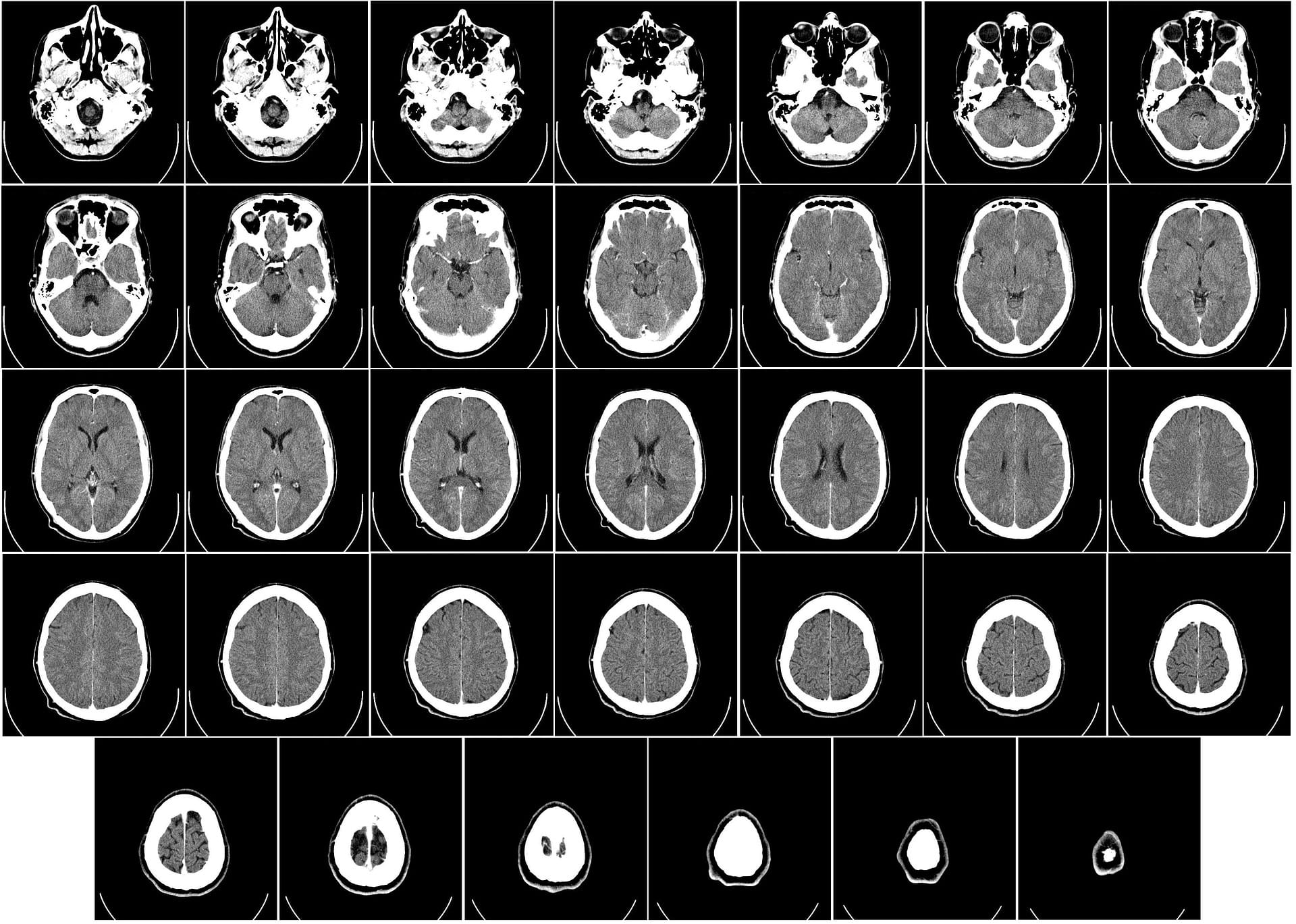 CT scan - Medical imaging